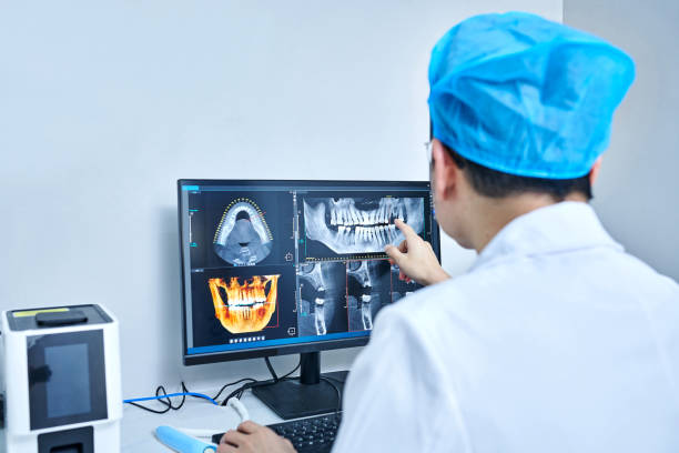 Best Emergency Dental Extractions in Wood Dale, IL